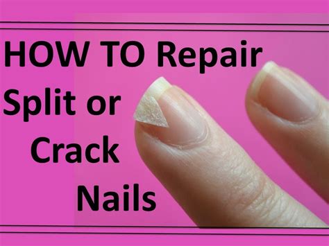 How do you stop a broken nail from hurting?