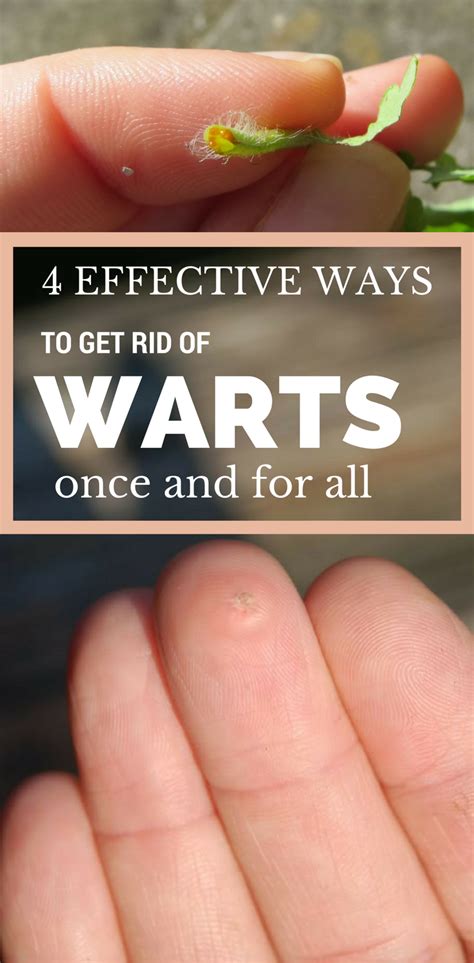 How do you stop warts from getting worse?