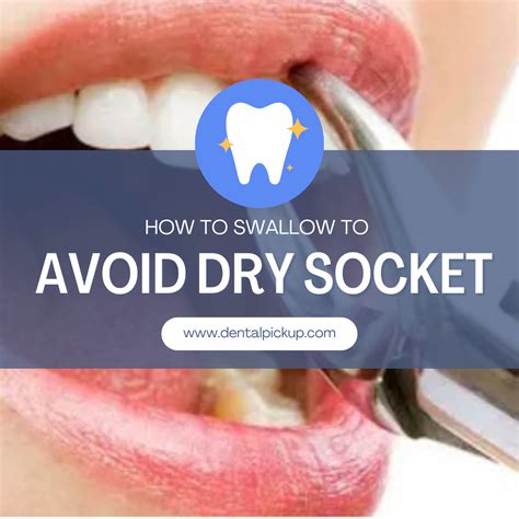 How do you swallow without getting dry socket?