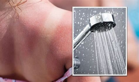 How do you take a shower with a sunburn?