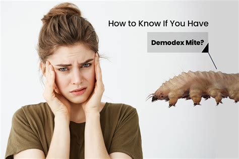 How do you tell if you have mites in your hair?