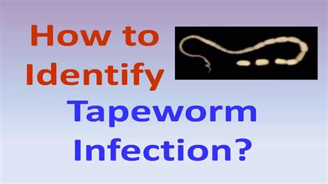How do you test for tapeworms?