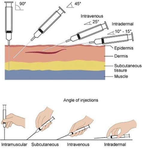 How do you tolerate an injection?