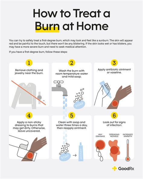 How do you treat a glue burn?