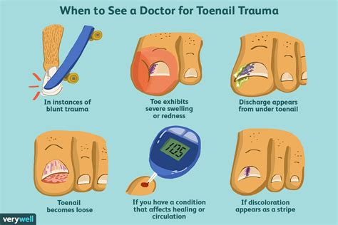 How do you treat a nail hit?