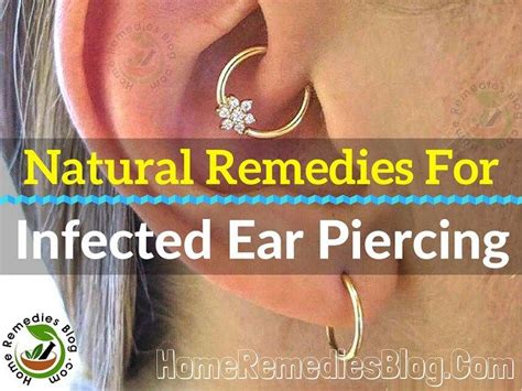How do you treat an infected ear piercing naturally?