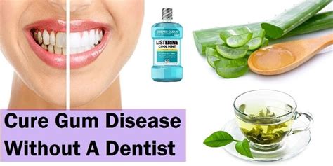 How do you treat gum disease without going to the dentist?
