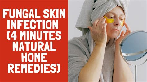 How do you treat skin fungus?