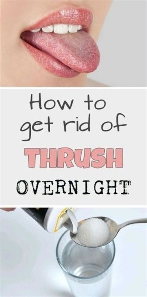 How do you treat thrush overnight?