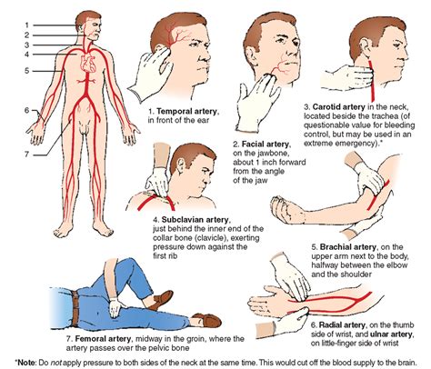 How do you use pressure points to slow capillary bleeding?