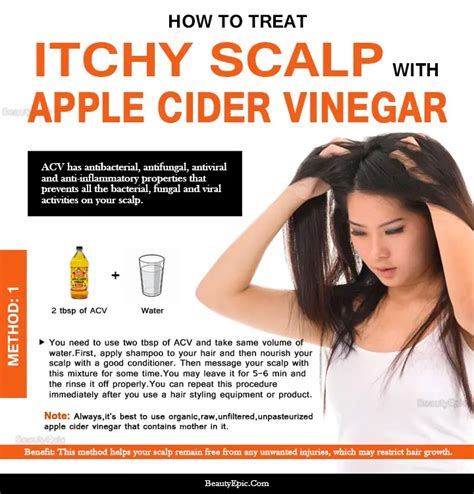 How do you use vinegar for scalp fungus?