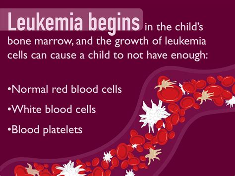 How does leukemia start?