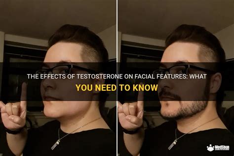 How does testosterone shape your face?