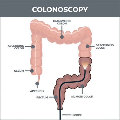 How far into intestines does a colonoscopy go?