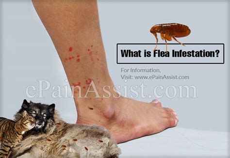 How fast can 1 flea cause an infestation?