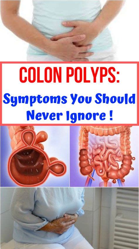 How fast do benign colon polyps grow?