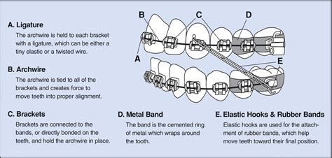 How fast do rubber bands move teeth?