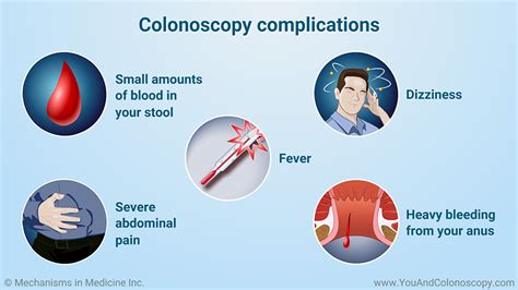 How fast do you wake up after colonoscopy?