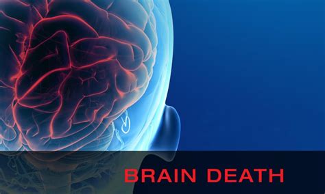 How fast is brain death?