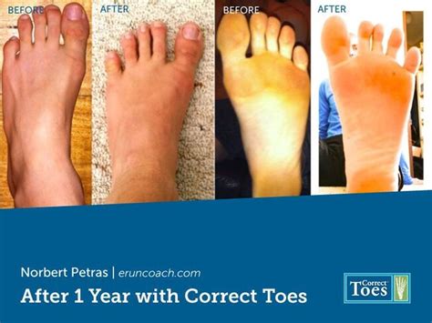 How feet should naturally look?
