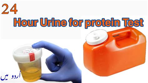 How is 24 hour urine test done?