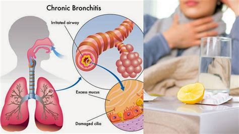 How is phlegm removed from kids lungs?