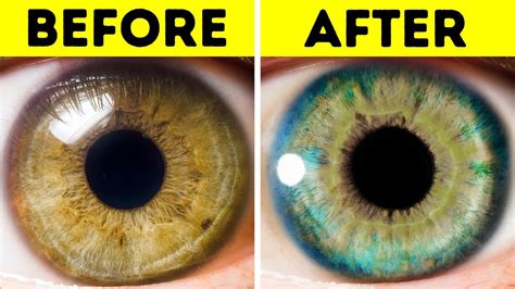 How late can eye Colour change?