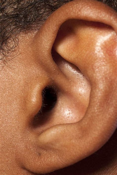 How long can a bug live in your ear?