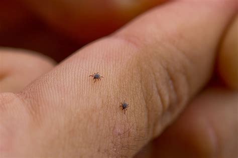 How long can a person have mites?