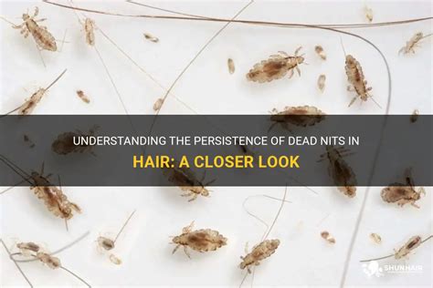 How long can dead nits stay in hair?