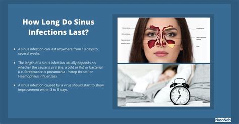 How long can sinusitis last?