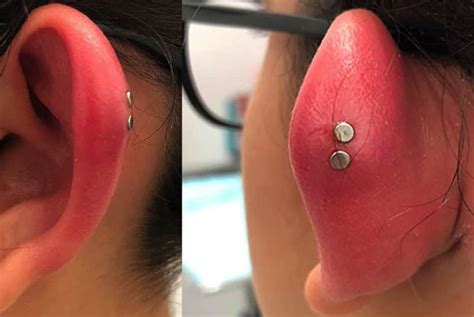 How long can swelling last after a piercing?