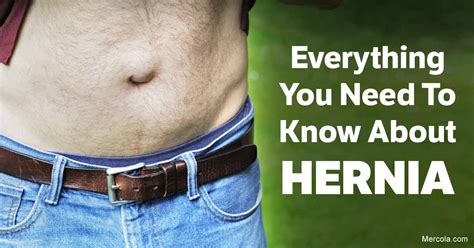 How long can you have a hernia without knowing?