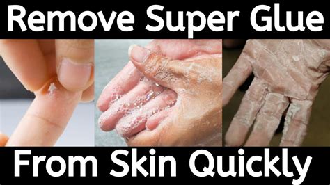 How long can you leave super glue on skin?