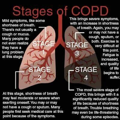 How long can you live in Stage 4 COPD?
