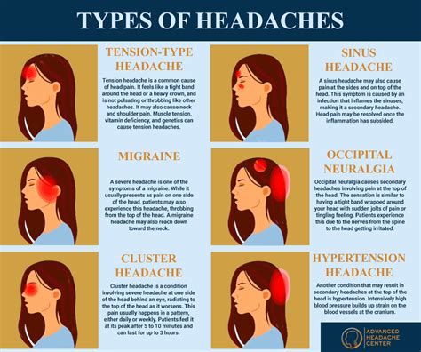 How long do air pressure headaches last?