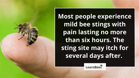 How long do bee stings hurt for?