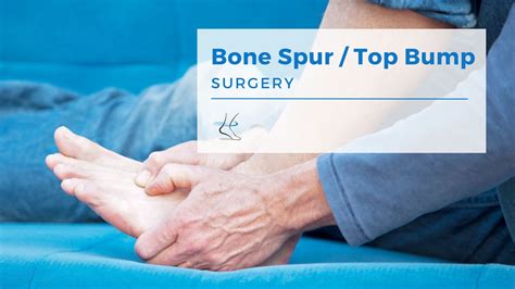 How long do bone spurs stay?