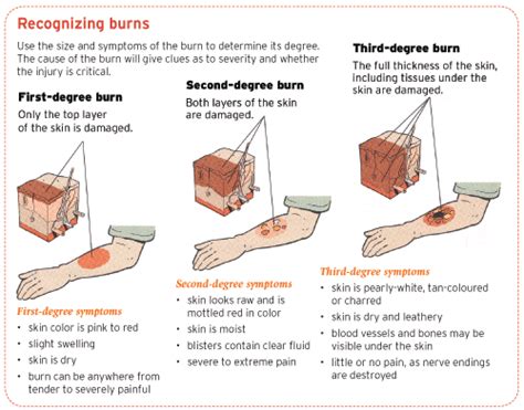 How long do burn victims feel pain?