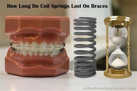 How long do coil springs last?