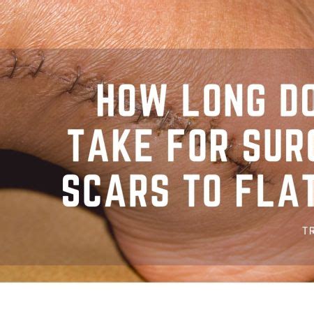 How long do scars turn white?