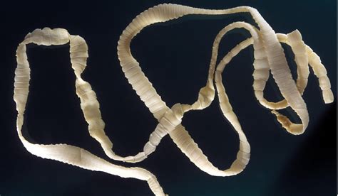 How long do tapeworms last untreated?