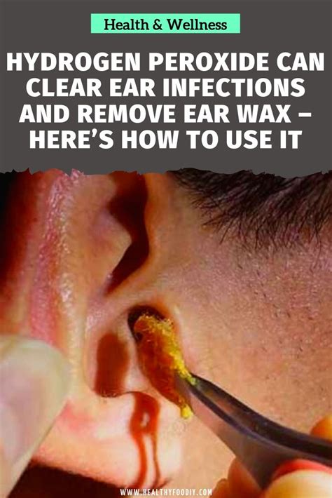 How long do you leave baking soda in your ear?