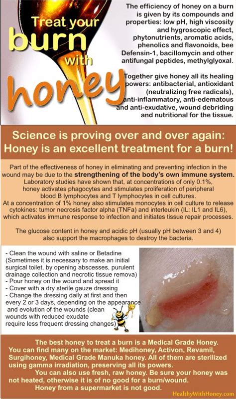 How long do you leave honey on sunburn?