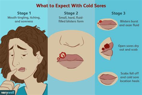 How long do you leave salt on a cold sore?