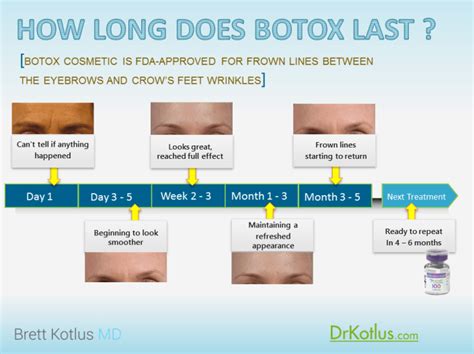 How long does Botox last in hair?