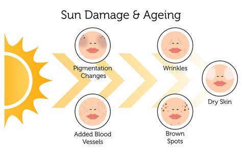 How long does UV damage take?