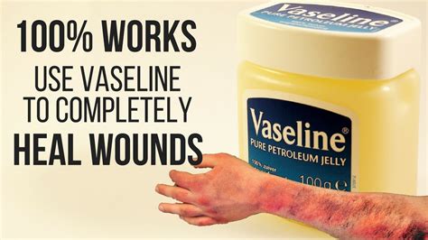 How long does Vaseline burn for?