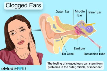 How long does a sinus clogged ear last?