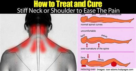 How long does a stiff neck last?
